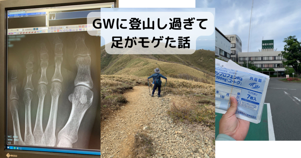 【登山の話】GWに登山で歩き過ぎて足がモゲた話。